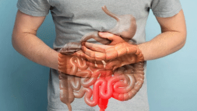Photo of शरीर में दिखने वाले ये 5 लक्षण करते हैं कोलन कैंसर का इशारा