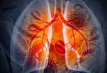 Photo of फेफड़ों के कैंसर के खिलाफ बड़ी कामयाबी