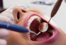 Photo of खराब ओरल हेल्थ कैसे बनती है बड़ी बीमारियों की वजह