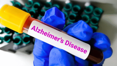Photo of लक्षण दिखने से 10 साल पहले ही पता चल सकेगा अल्जाइमर का खतरा