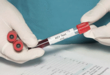 Photo of विश्व एड्स दिवस पर दूर करें इस बीमारी से जुड़ी 3 मिथक