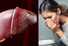 Photo of त्वचा पर नजर आते हैं लिवर की खराबी के 5 लक्षण