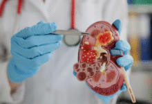 Photo of क्या आपको भी है किडनी स्टोन के दोबारा लौटने का डर?