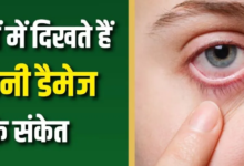 Photo of किडनी खराब होने से पहले आंखें देती हैं 6 संकेत