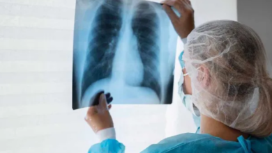 Photo of कमजोर इम्युनिटी और खराब जीवनशैली दे रही टीबी को न्योता